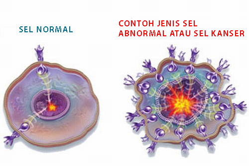 Gambar-Sel-kanser-dan-sel-normal