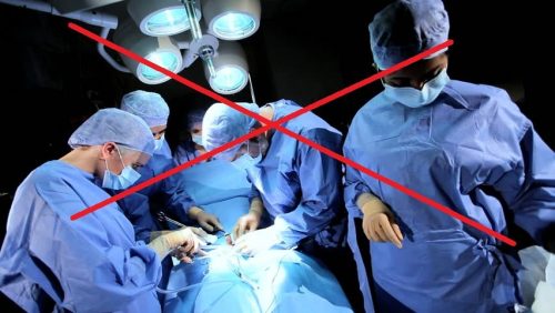 tidak-bedah-cyst tidak-bedah-cyst